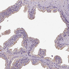 Anti-ISLR Antibody