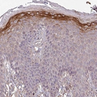 Immunohistochemical staining of human skin shows moderate cytoplasmic positivity in epidermal cells.