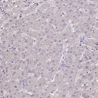 Immunohistochemical staining of human liver shows very weak cytoplasmic positivity in hepatocytes.