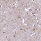Anti-FAM43B Antibody