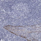 Immunohistochemical staining of human tonsil shows weak to moderate cytoplasmic positivity in squamous epithelial cells.