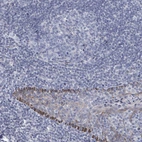 Immunohistochemical staining of human tonsil shows weak to moderate cytoplasmic positivity in squamous epithelial cells.