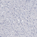 Immunohistochemical staining of human liver shows no positivity in hepatocytes as expected.