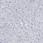 Immunohistochemical staining of human liver shows no positivity in hepatocytes as expected.