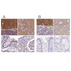 Immunohistochemical staining of human cerebellum, cerebral cortex, colon and kidney using Anti-SLC8A2 antibody HPA050818 (A) shows similar protein distribution across tissues to independent antibody HPA054671 (B).