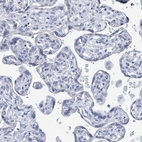Immunohistochemical staining of human placenta shows no positivity in trophoblastic cells as expected.