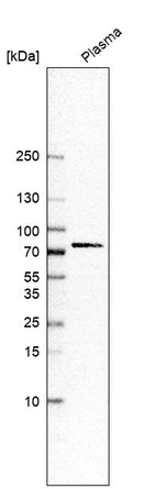 Western blot analysis in human plasma.
