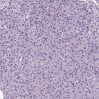 Immunohistochemical staining of human pancreas shows low expression as expected.