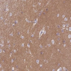 Immunohistochemical staining of human cerebral cortex shows high expression.