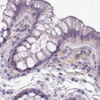 Immunohistochemical staining of human colon using Anti-SLC8A2 antibody HPA050818.