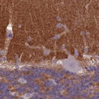 Anti-SLC8A2 Antibody