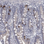 Anti-SLC25A45 Antibody