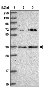 Lane 1: Marker [kDa] 250, 130, 95, 72, 55, 36, 28, 17, 10_br/_Lane 2: Human cell line RT-4_br/_Lane 3: Human cell line U-251MG sp