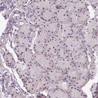 Anti-UVSSA Antibody