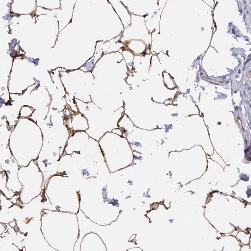 Anti-TUSC5 Antibody