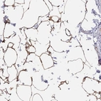 Anti-TUSC5 Antibody