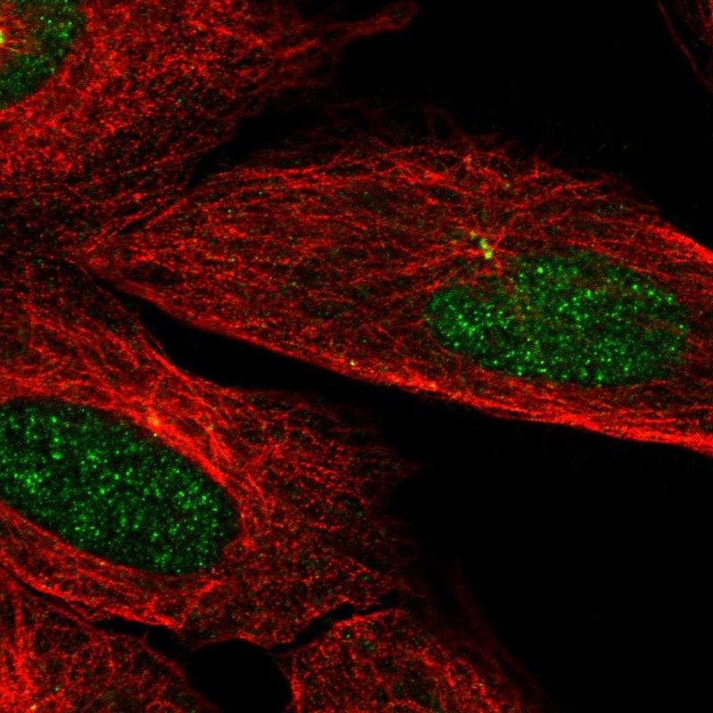 Anti-CAMK2N2 Antibody