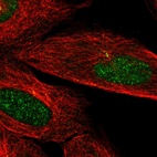Anti-CAMK2N2 Antibody