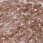 Anti-BDKRB2 Antibody