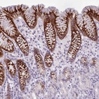Immunohistochemical staining of human stomach shows strong membranous positivity in glandular cells.
