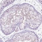 Immunohistochemical staining of human testis shows low positivity in cells in seminiferous ducts as expected.