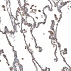 Immunohistochemical staining of human lung shows moderate cytoplasmic positivity in macrophages.