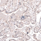 Anti-TET3 Antibody