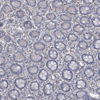 Immunohistochemical staining of human small intestine shows moderate cytoplasmic positivity in lymphoid cells.