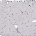 Immunohistochemical staining of human skeletal muscle shows no cytoplasmic positivity as expected.