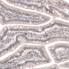 Immunohistochemical staining of human duodenum shows weak nuclear positivity in a subset of glandular cells.