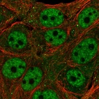 Immunofluorescent staining of human cell line MCF7 shows localization to nucleoplasm, cytosol & vesicles.