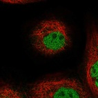 Anti-TOGARAM1 Antibody