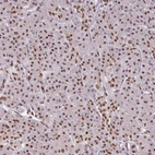Anti-IRF2BPL Antibody