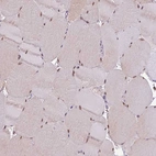 Immunohistochemical staining of human skeletal muscle shows moderate nuclear positivity in myocytes.