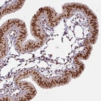 Immunohistochemical staining of human fallopian tube shows strong nuclear positivity in glandular cells.