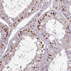Immunohistochemical staining of human testis shows moderate positivity in cells in seminiferous ducts.