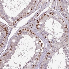 Immunohistochemical staining of human testis shows moderate positivity in cells in seminiferous ducts.