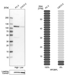 Western blot analysis in human cell lines PC-3 and Caco-2 using Anti-IRF2BPL antibody. Corresponding IRF2BPL RNA-seq data are presented for the same cell lines. Loading control: Anti-COX4I1.