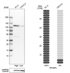 Western blot analysis in human cell lines PC-3 and Caco-2 using Anti-IRF2BPL antibody. Corresponding IRF2BPL RNA-seq data are presented for the same cell lines. Loading control: Anti-COX4I1.