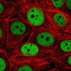 Immunofluorescent staining of human cell line MCF7 shows localization to nucleoplasm.