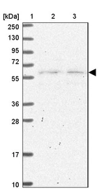Lane 1: Marker [kDa] 250, 130, 95, 72, 55, 36, 28, 17, 10_br/_Lane 2: Human cell line RT-4_br/_Lane 3: Human cell line U-251MG sp