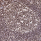 Immunohistochemical staining of human tonsil shows strong nuclear positivity in germinal center cells.