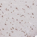 Immunohistochemical staining of human cerebral cortex shows strong nuclear positivity in neurons.