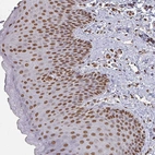 Immunohistochemical staining of human skin shows strong nuclear positivity in squamous epithelial cells.