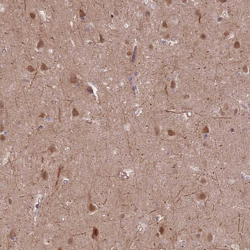 Anti-ZNF391 Antibody