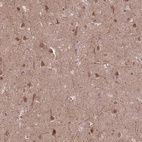 Anti-ZNF391 Antibody