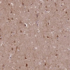 Anti-ZNF391 Antibody
