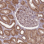 Immunohistochemical staining of human kidney shows strong nuclear positivity in cells in glomeruli.
