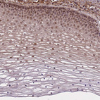 Immunohistochemical staining of human cervix shows strong nuclear positivity in squamous epithelial cells.