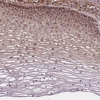 Immunohistochemical staining of human cervix shows strong nuclear positivity in squamous epithelial cells.